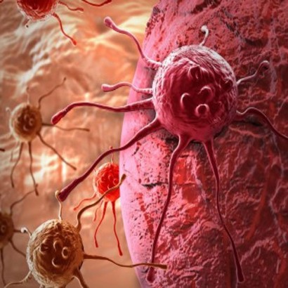 نانوذراتی چندکاره با قابلیت تعقیب و نابودی سلول‌های سرطانی