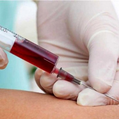 تزریق خون افراد نوجوان به افراد پیر برای جوانسازی