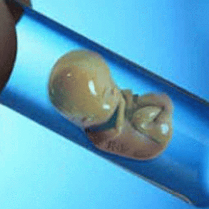 کشت اولین جنین مصنوعی جهان