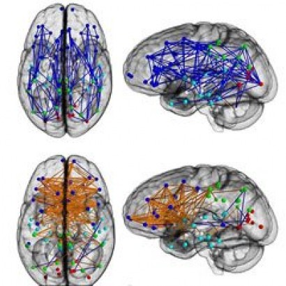 تفاوت در ساختاربندی مغز زنان و مردان!