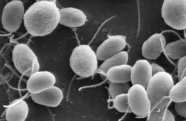 جداسازی 4 باکتری با خاصیت ضدسرطانی از خاک‌های ایران