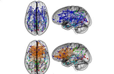 تفاوت در ساختاربندی مغز زنان و مردان!