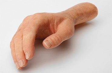 اعضای مصنوعی