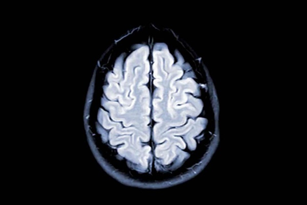 کم خوابی باعث پیر شدن مغز می‌شود!