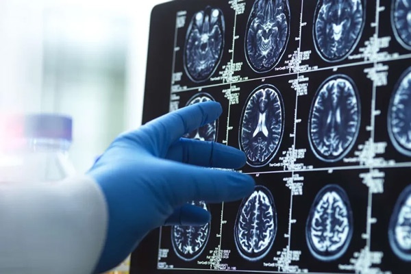 ۴ مرحله اصلی رشد مغز انسان